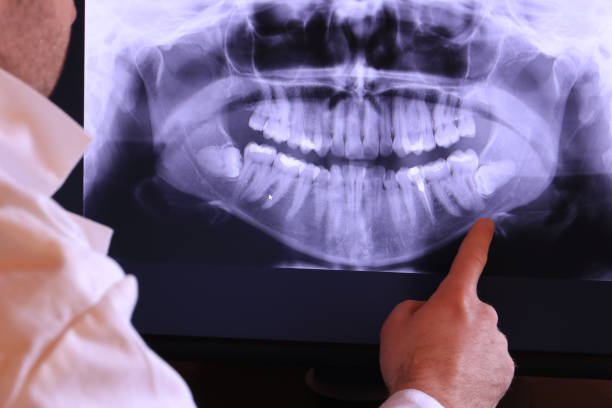 Best Emergency Root Canal Treatment in Springfield, CO